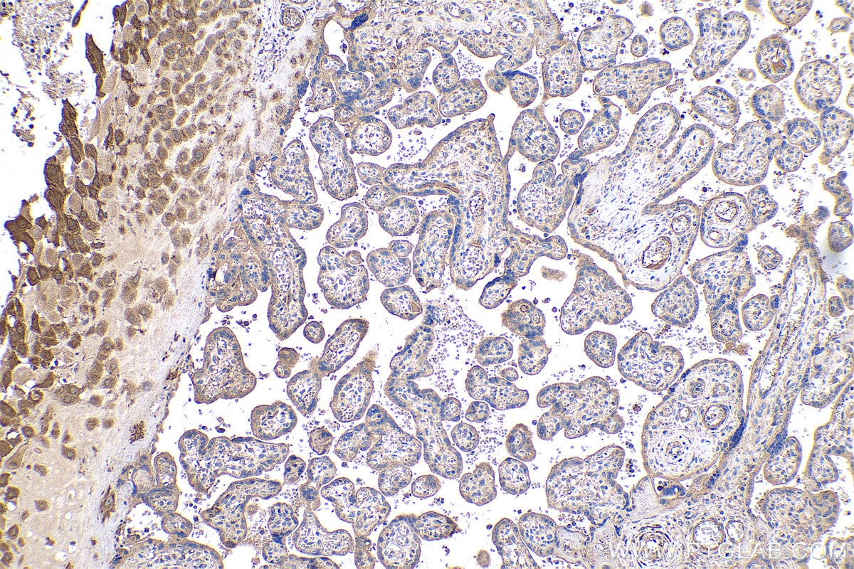 Immunohistochemical analysis of paraffin-embedded human placenta tissue slide using KHC0452 (RARRES2 IHC Kit).