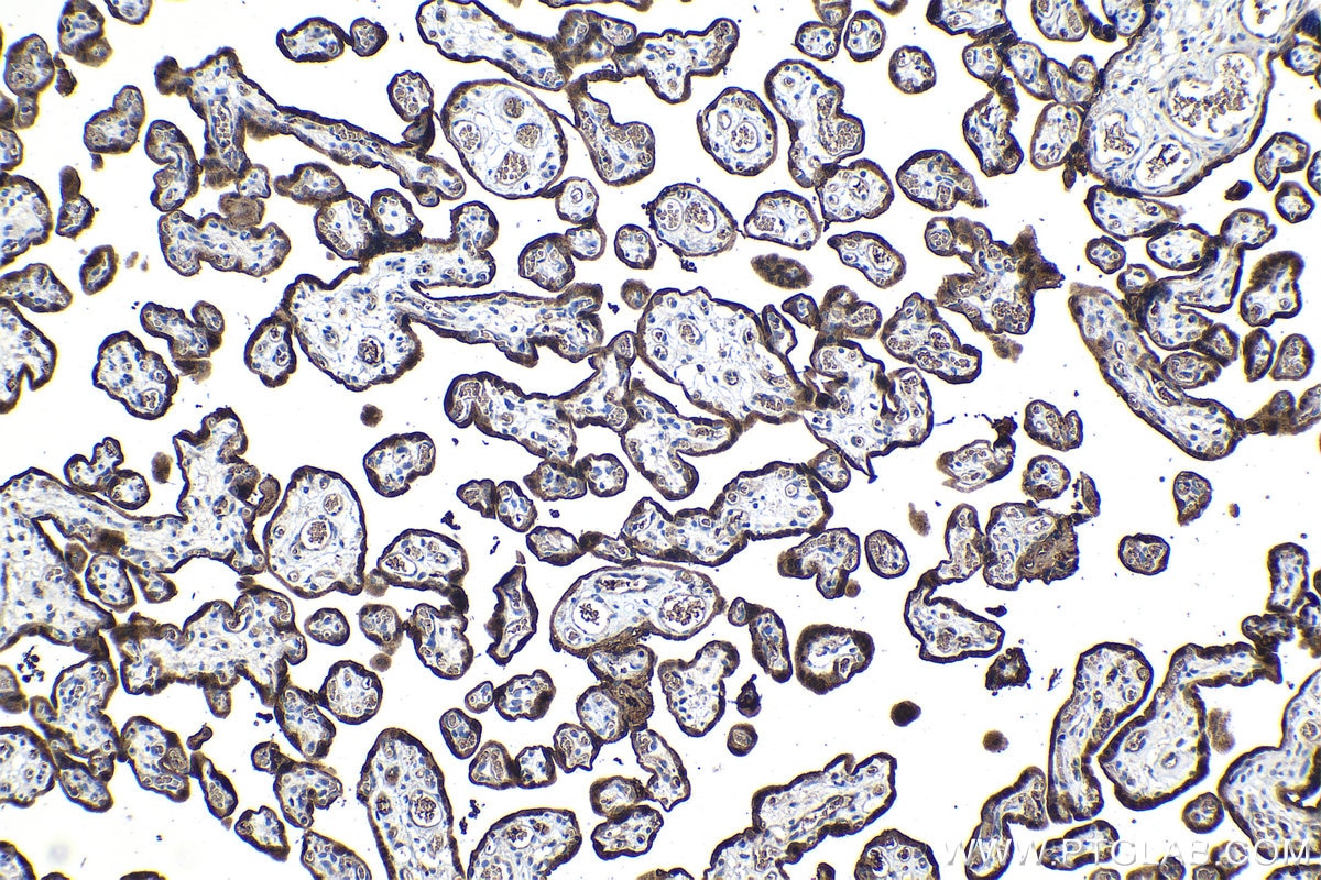 Immunohistochemical analysis of paraffin-embedded human placenta tissue slide using KHC1058 (RASA1 IHC Kit).