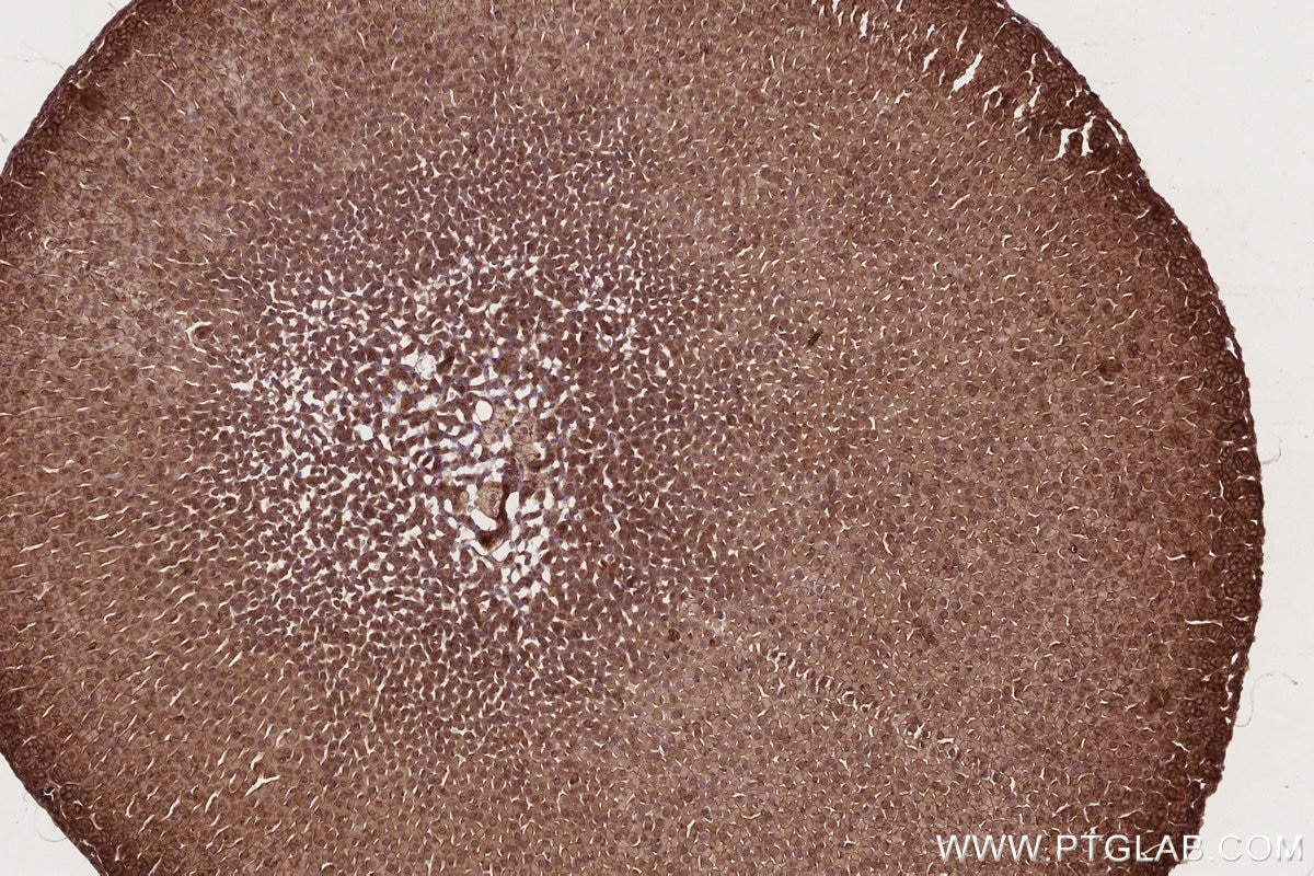 Immunohistochemical analysis of paraffin-embedded mouse adrenal gland tissue slide using KHC2721 (RB1CC1 IHC Kit).