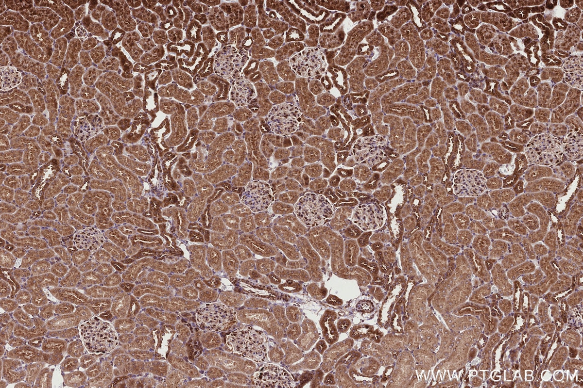 Immunohistochemical analysis of paraffin-embedded rat kidney tissue slide using KHC2721 (RB1CC1 IHC Kit).