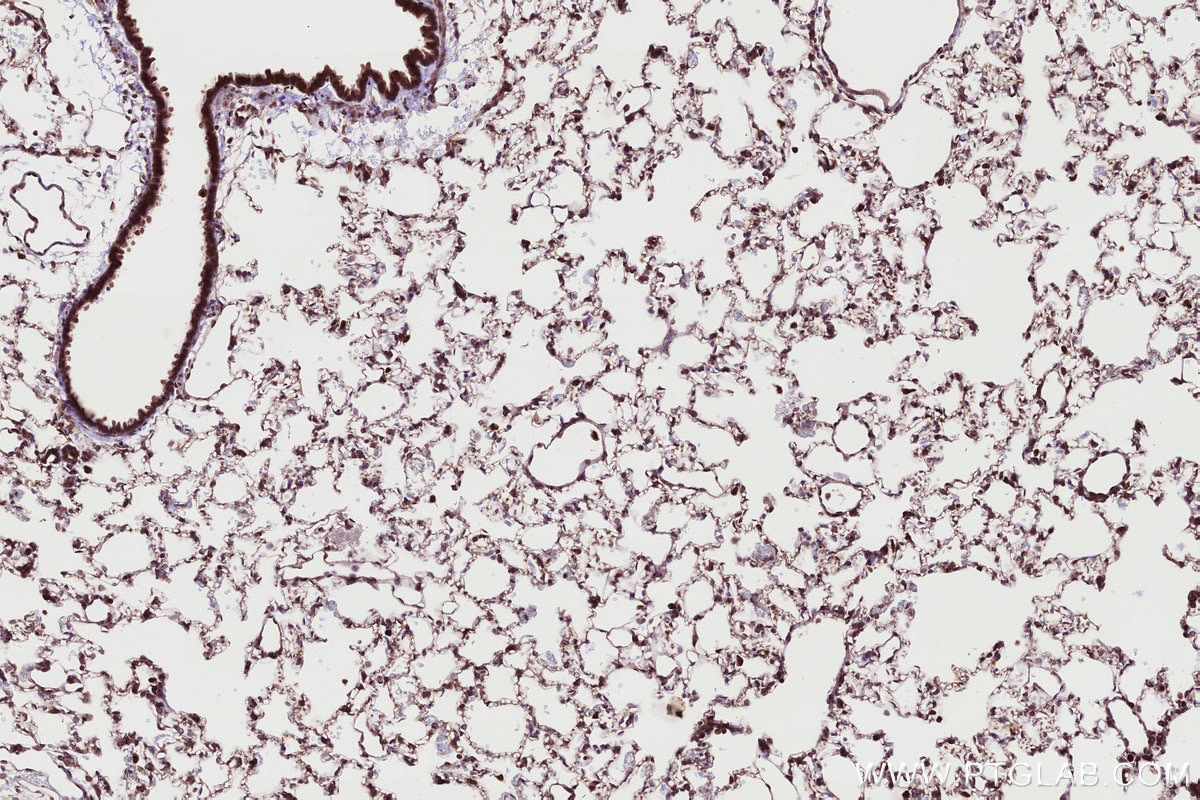 Immunohistochemical analysis of paraffin-embedded rat lung tissue slide using KHC2721 (RB1CC1 IHC Kit).