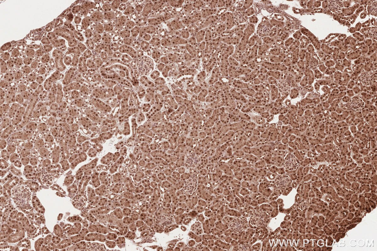 Immunohistochemical analysis of paraffin-embedded mouse kidney tissue slide using KHC2624 (RBBP6 IHC Kit).