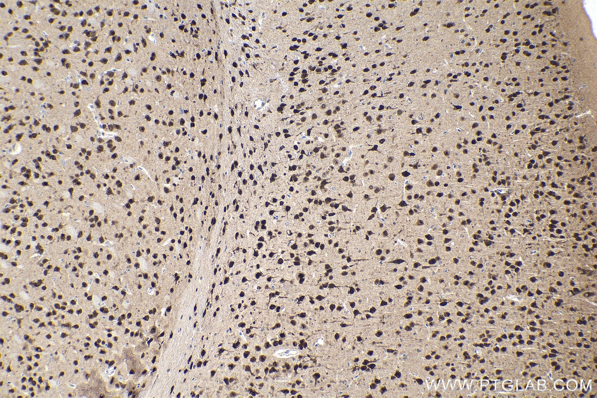 Immunohistochemical analysis of paraffin-embedded mouse brain tissue slide using KHC1966 (RBFOX1/A2BP1 IHC Kit).