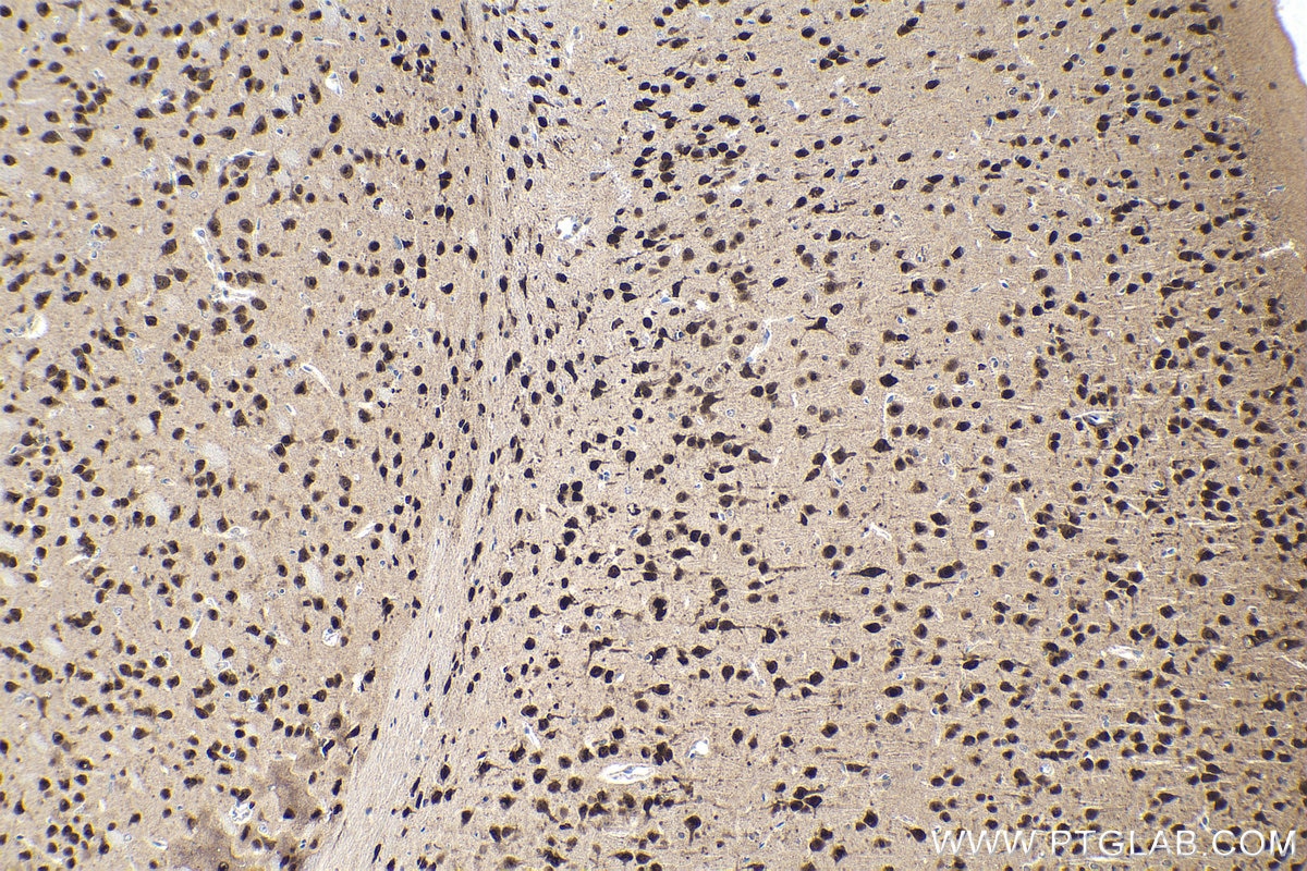 Immunohistochemical analysis of paraffin-embedded mouse brain tissue slide using KHC1966 (RBFOX1/A2BP1 IHC Kit).