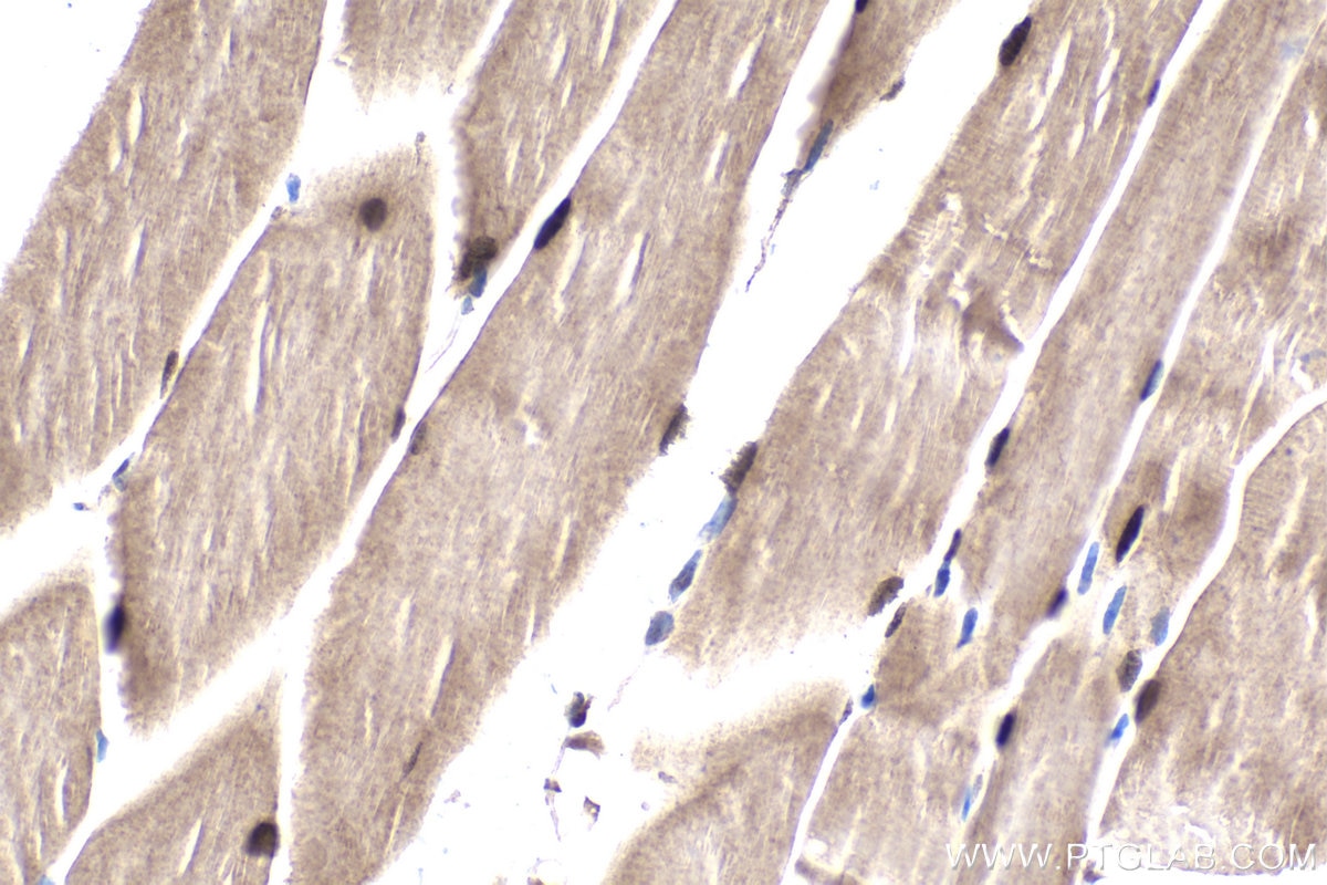 Immunohistochemical analysis of paraffin-embedded mouse skeletal muscle tissue slide using KHC1966 (RBFOX1/A2BP1 IHC Kit).