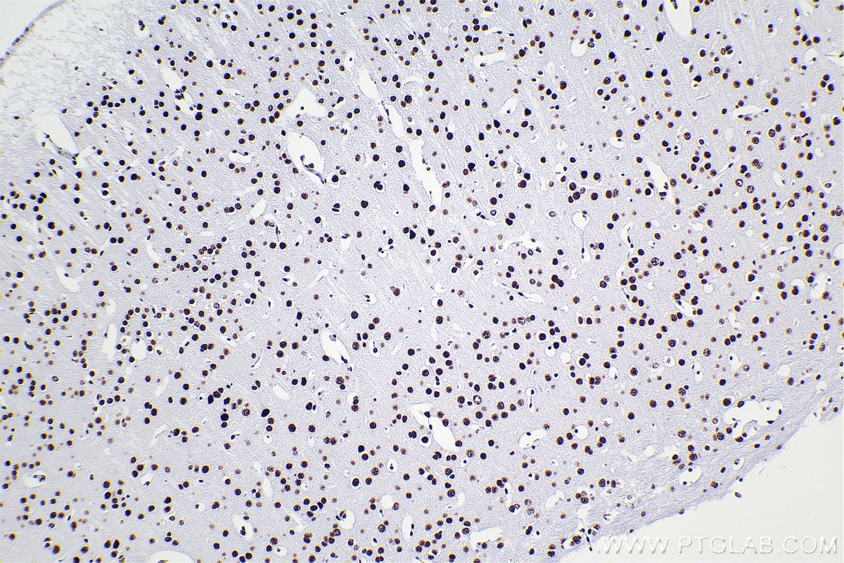 Immunohistochemical analysis of paraffin-embedded mouse brain tissue slide using KHC2378 (RBM10 IHC Kit).