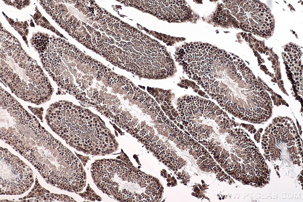 Immunohistochemical analysis of paraffin-embedded mouse testis tissue slide using KHC0150 (RBM15 IHC Kit).
