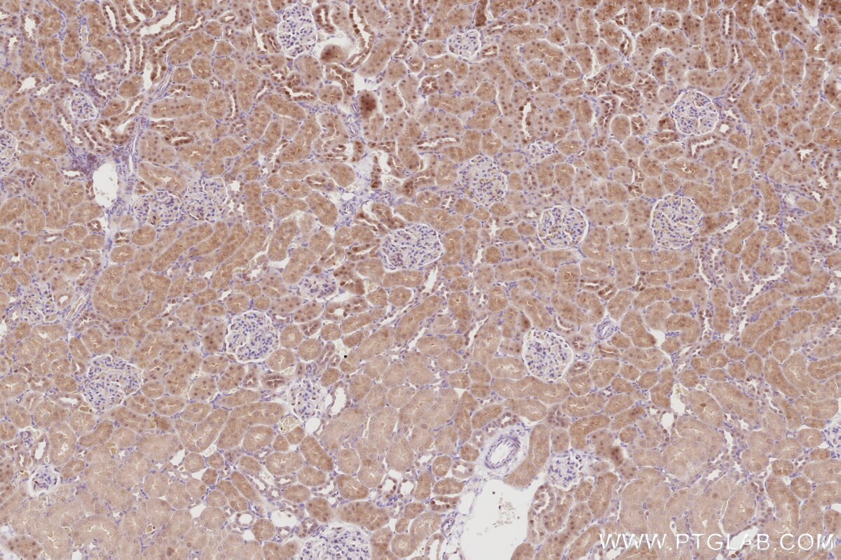 Immunohistochemical analysis of paraffin-embedded rat kidney tissue slide using KHC2901 (RBM38 IHC Kit).