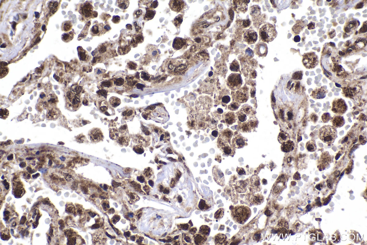 Immunohistochemical analysis of paraffin-embedded human lung tissue slide using KHC2028 (RBM8A IHC Kit).