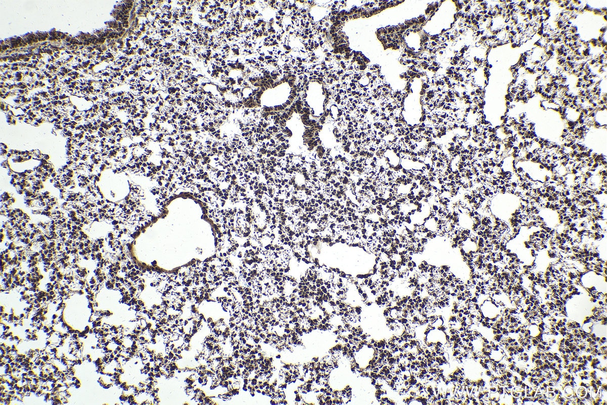 Immunohistochemical analysis of paraffin-embedded mouse lung tissue slide using KHC2028 (RBM8A IHC Kit).