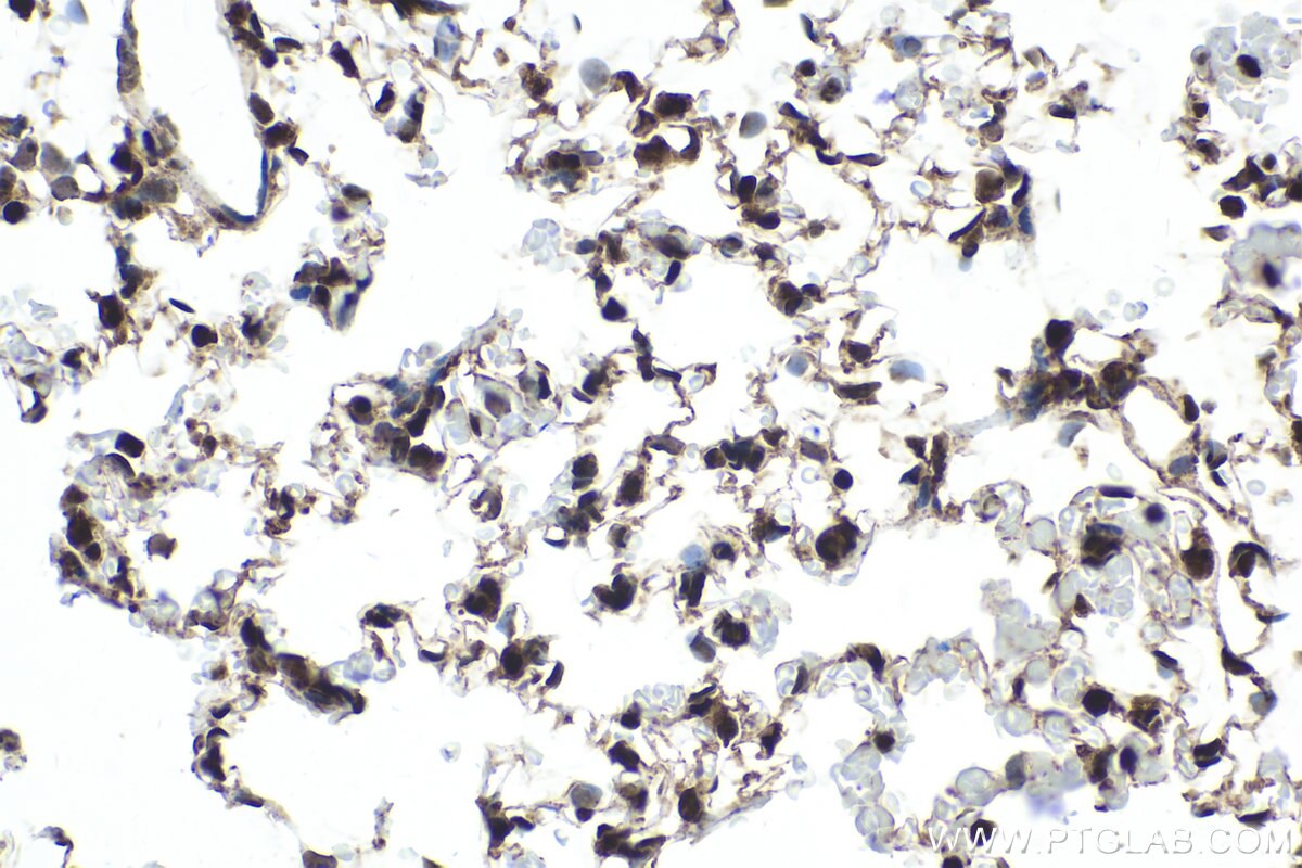 Immunohistochemical analysis of paraffin-embedded rat lung tissue slide using KHC2028 (RBM8A IHC Kit).