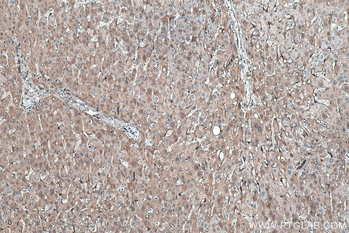 Immunohistochemical analysis of paraffin-embedded human liver tissue slide using KHC0453 (RBP1 IHC Kit).