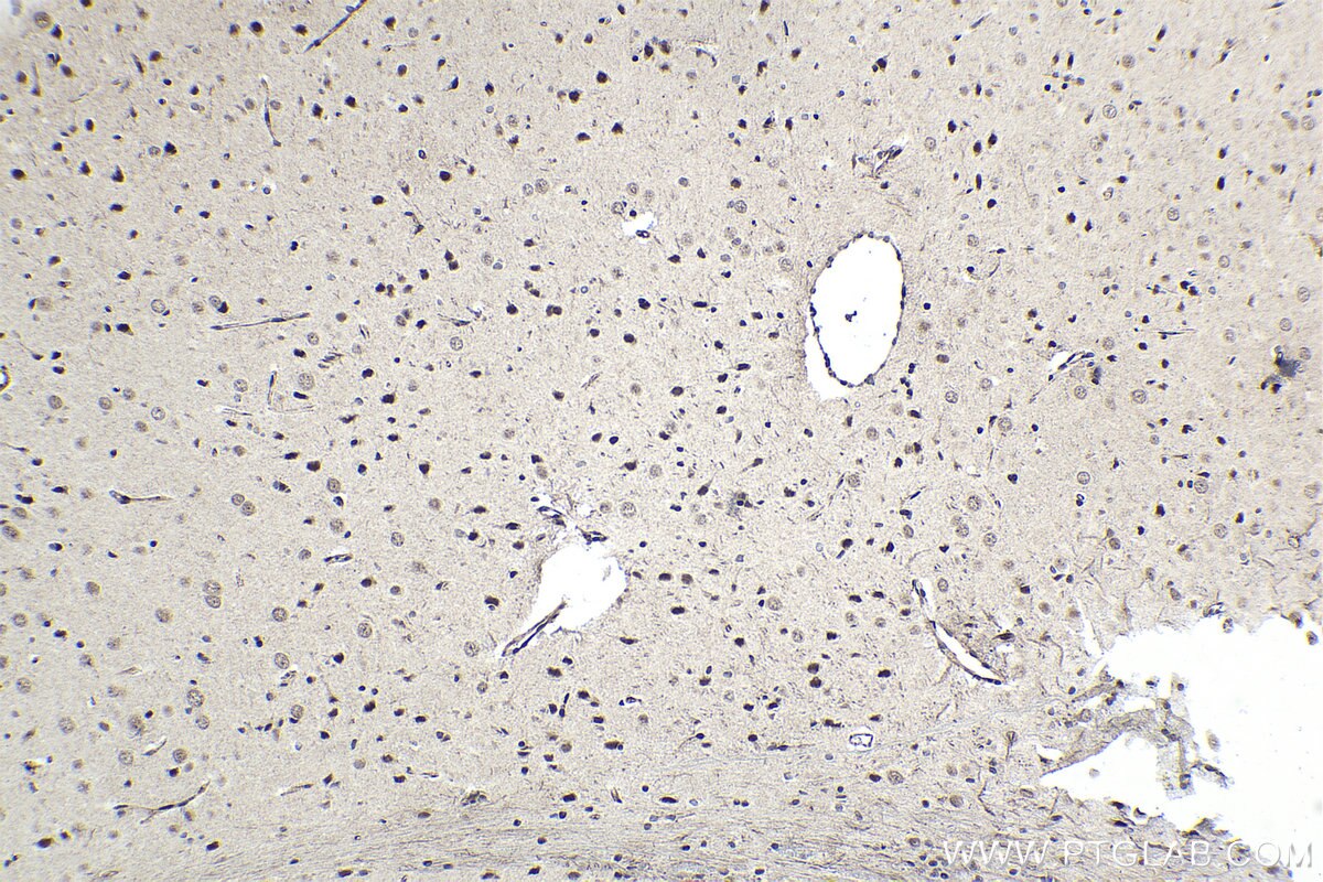 Immunohistochemical analysis of paraffin-embedded rat brain tissue slide using KHC1679 (RBPJ IHC Kit).