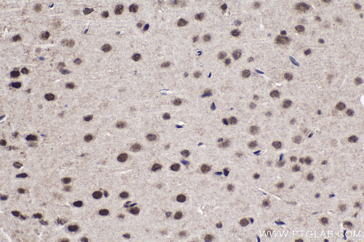 Immunohistochemical analysis of paraffin-embedded mouse brain tissue slide using KHC1679 (RBPJ IHC Kit).