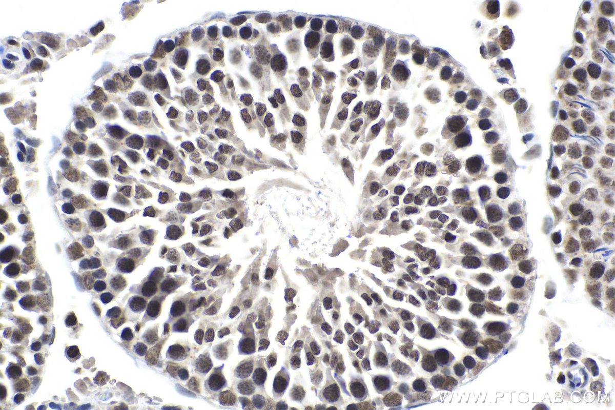 Immunohistochemical analysis of paraffin-embedded rat testis tissue slide using KHC1679 (RBPJ IHC Kit).