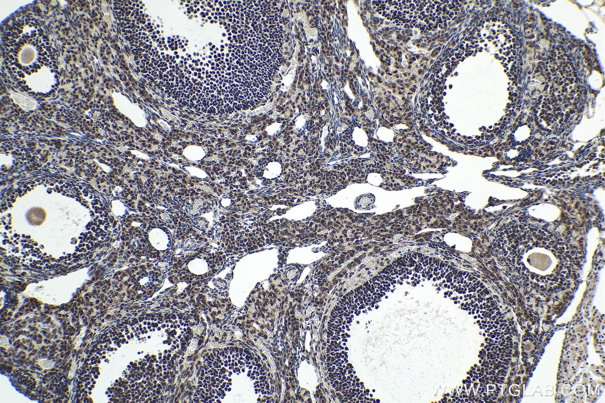 Immunohistochemical analysis of paraffin-embedded mouse ovary tissue slide using KHC1679 (RBPJ IHC Kit).