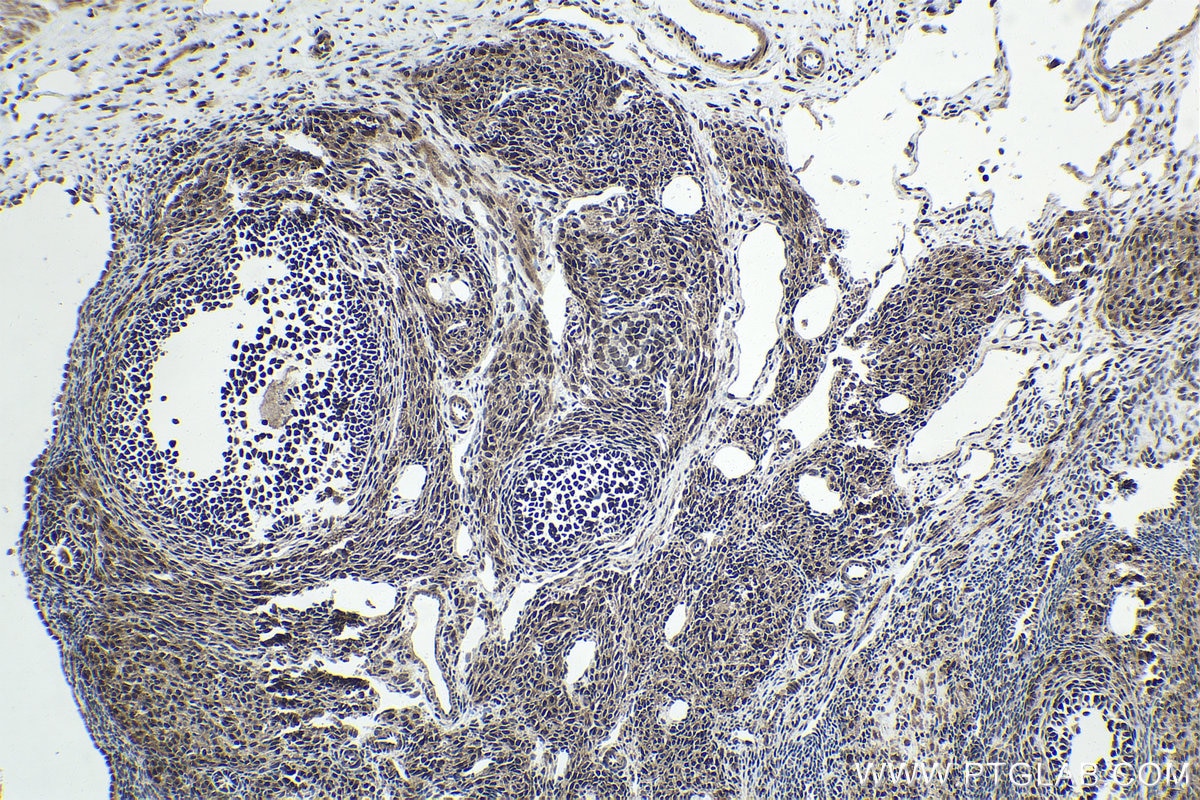 Immunohistochemical analysis of paraffin-embedded rat ovary tissue slide using KHC1679 (RBPJ IHC Kit).