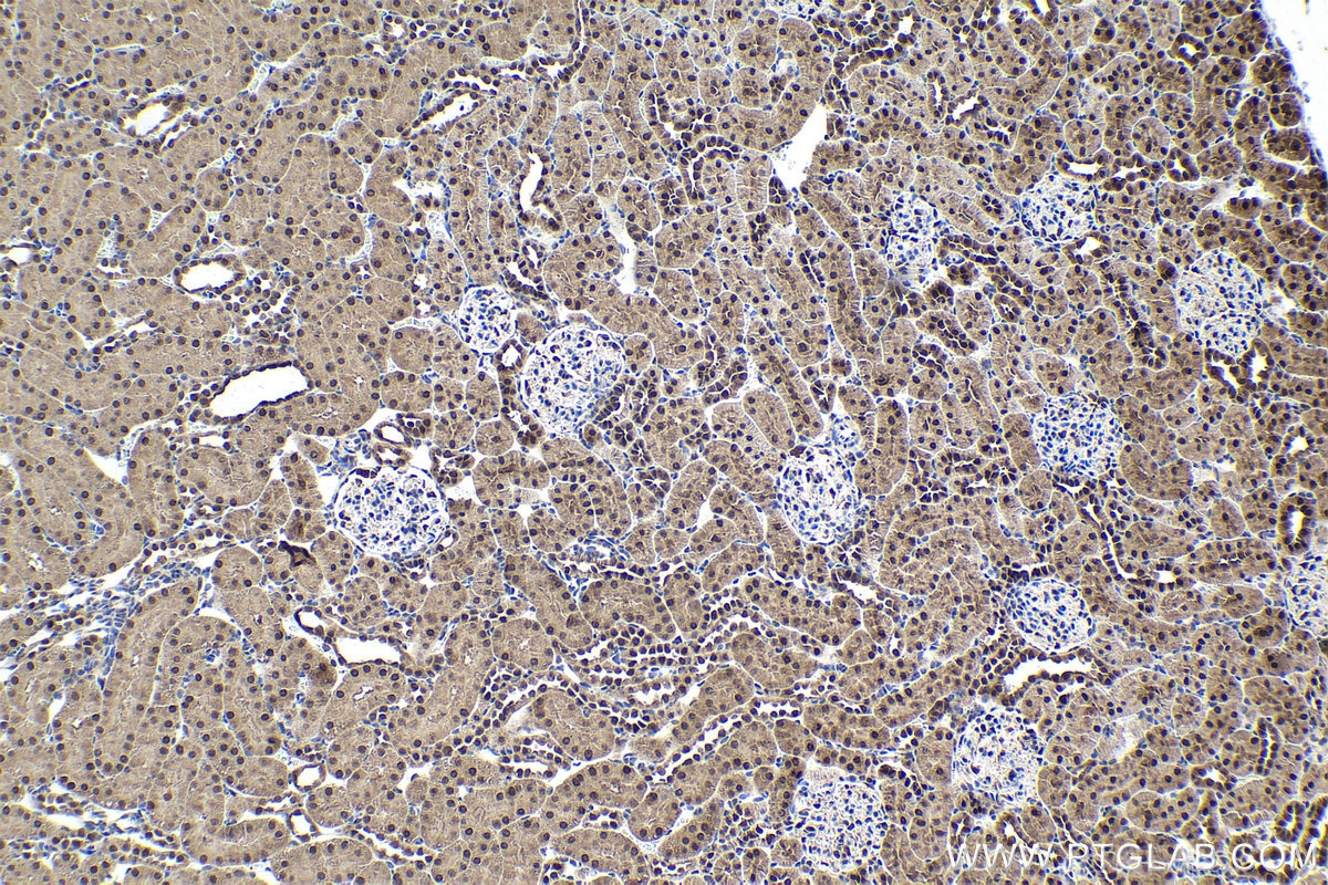 Immunohistochemical analysis of paraffin-embedded rat kidney tissue slide using KHC1648 (RBX1 IHC Kit).