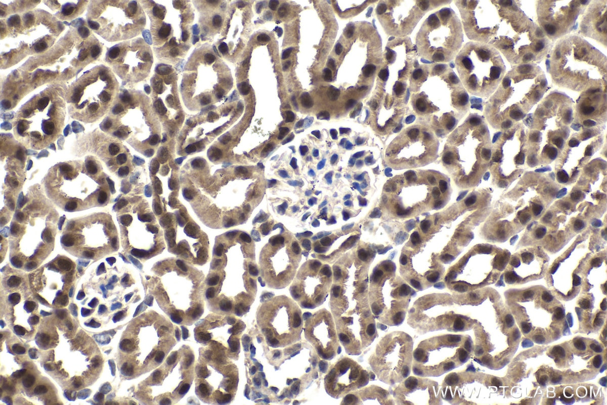 Immunohistochemical analysis of paraffin-embedded mouse kidney tissue slide using KHC1648 (RBX1 IHC Kit).