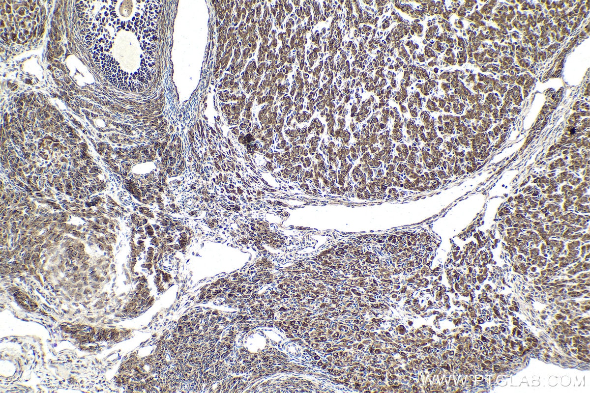 Immunohistochemical analysis of paraffin-embedded rat ovary tissue slide using KHC2050 (RCAS1 IHC Kit).