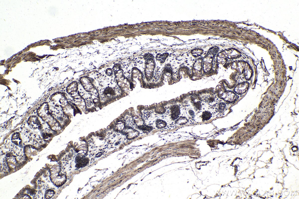 Immunohistochemical analysis of paraffin-embedded rat colon tissue slide using KHC1015 (RCC2 IHC Kit).