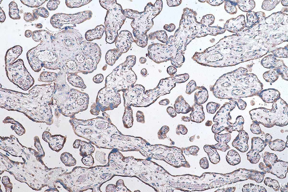 Immunohistochemical analysis of paraffin-embedded human placenta tissue slide using KHC0862 (RCN2 IHC Kit).