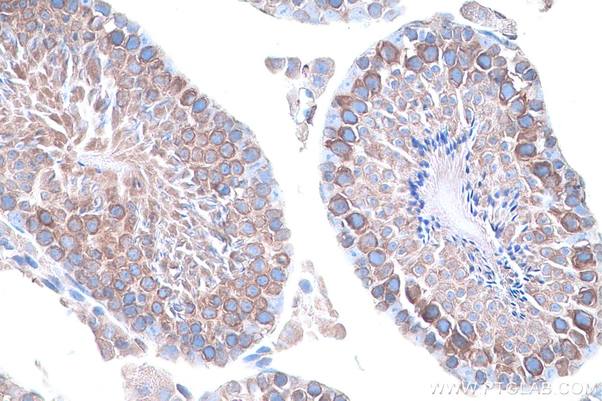 Immunohistochemical analysis of paraffin-embedded mouse testis tissue slide using KHC0862 (RCN2 IHC Kit).