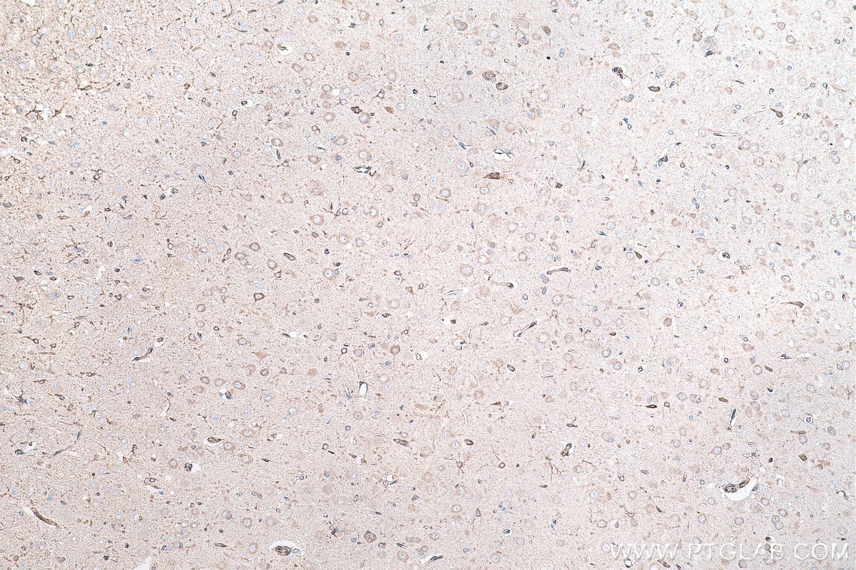 Immunohistochemical analysis of paraffin-embedded rat brain tissue slide using KHC0862 (RCN2 IHC Kit).