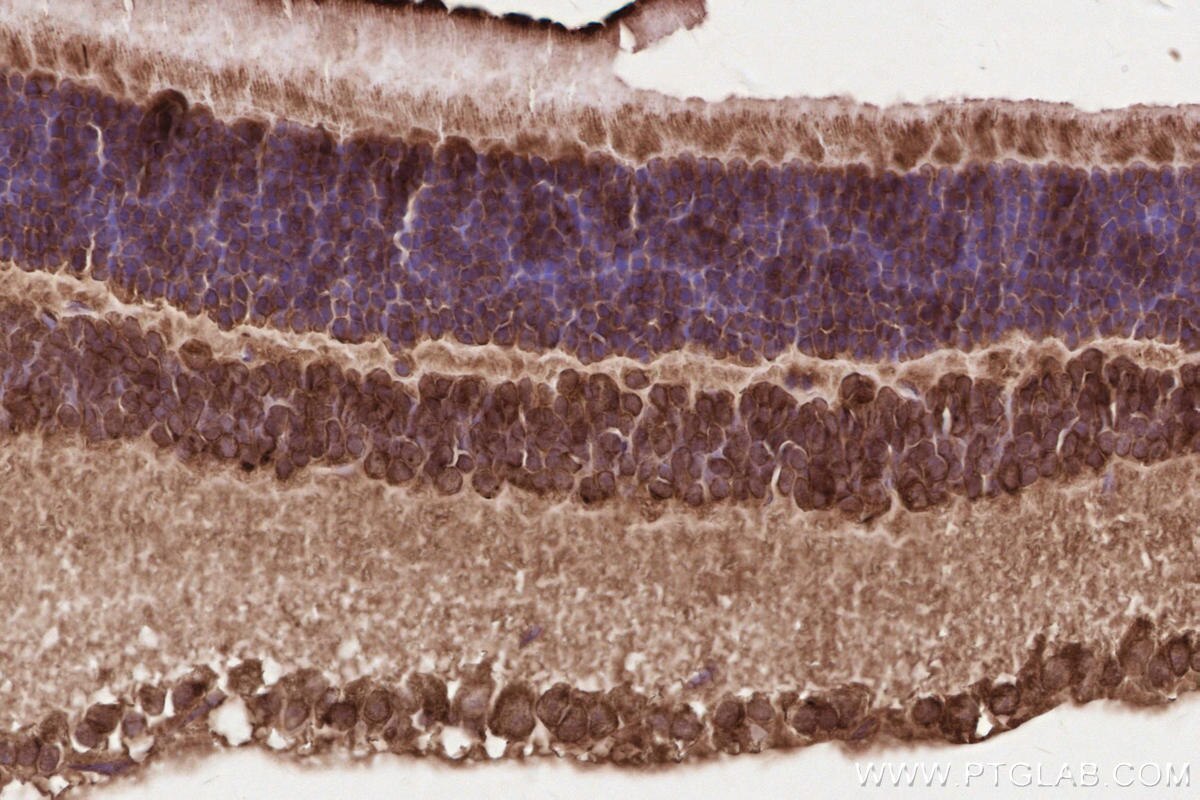 Immunohistochemical analysis of paraffin-embedded mouse eye tissue slide using KHC2619 (RD3 IHC Kit).