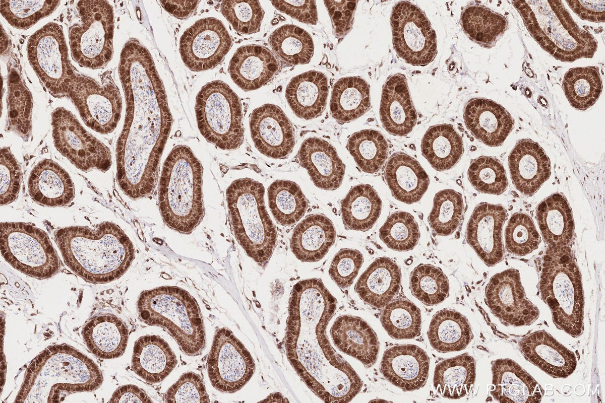 Immunohistochemical analysis of paraffin-embedded mouse epididymis tissue slide using KHC2619 (RD3 IHC Kit).