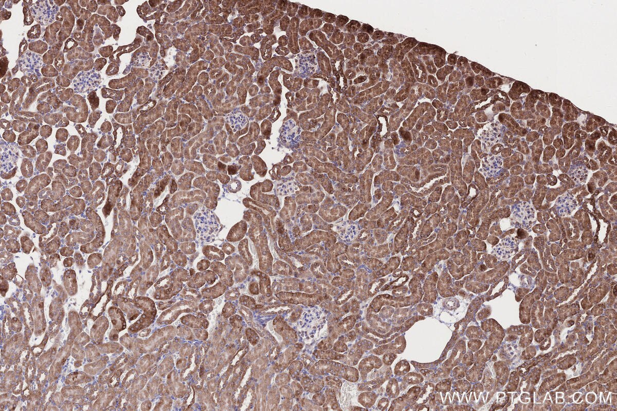 Immunohistochemical analysis of paraffin-embedded mouse kidney tissue slide using KHC2665 (RDH10 IHC Kit).