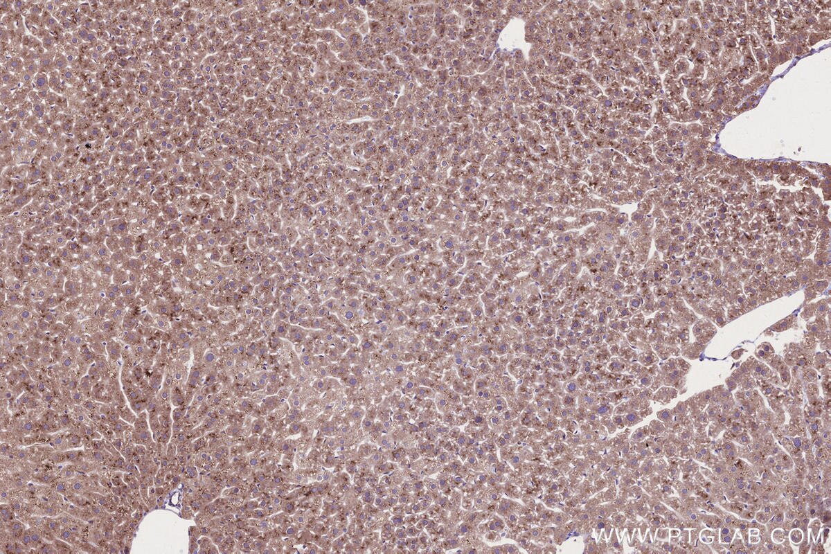 Immunohistochemical analysis of paraffin-embedded mouse liver tissue slide using KHC2665 (RDH10 IHC Kit).