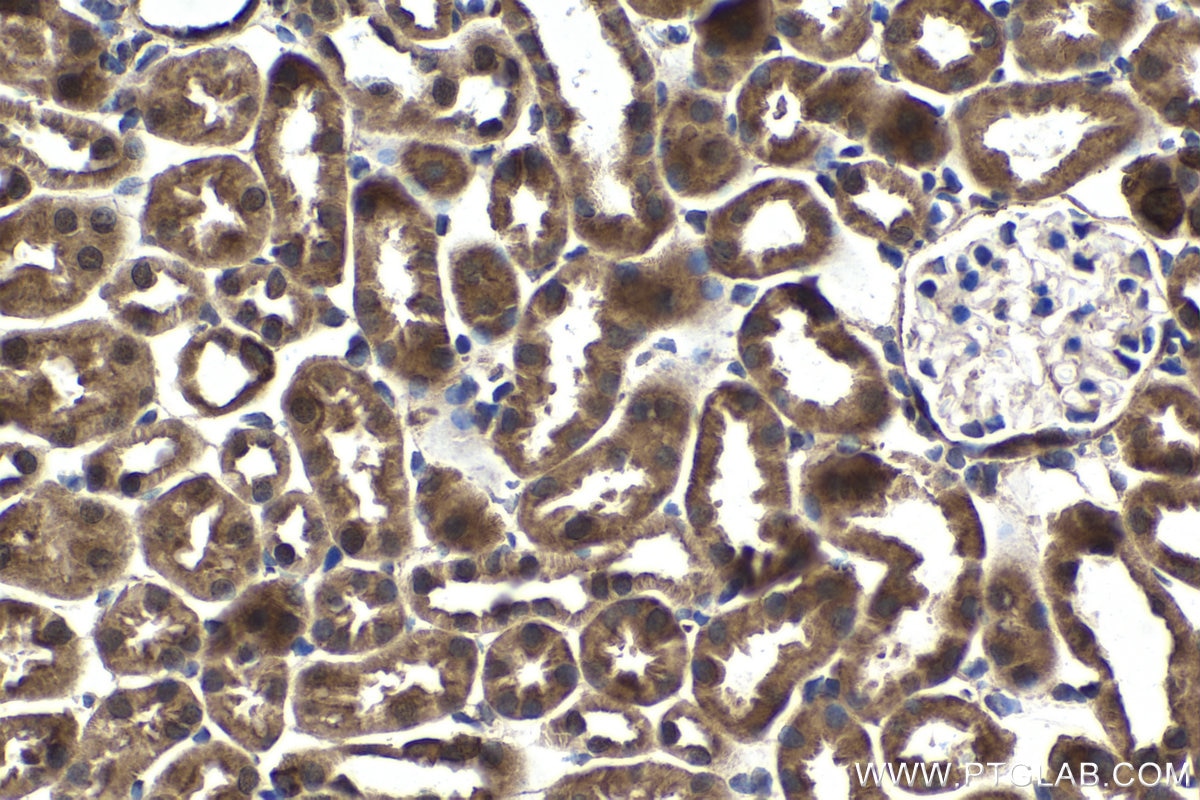 Immunohistochemical analysis of paraffin-embedded mouse kidney tissue slide using KHC1664 (RELB IHC Kit).