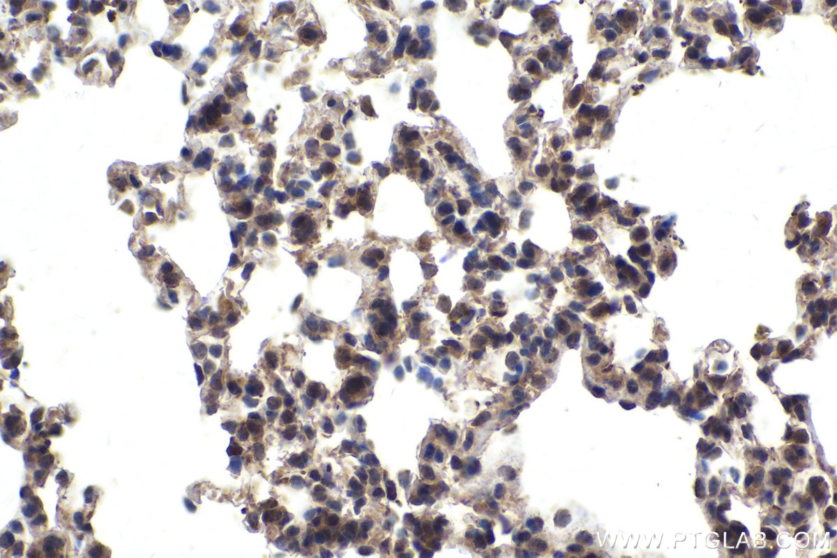 Immunohistochemical analysis of paraffin-embedded mouse lung tissue slide using KHC1664 (RELB IHC Kit).