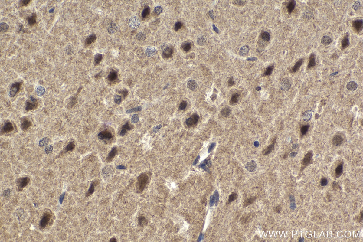 Immunohistochemical analysis of paraffin-embedded rat brain tissue slide using KHC1664 (RELB IHC Kit).