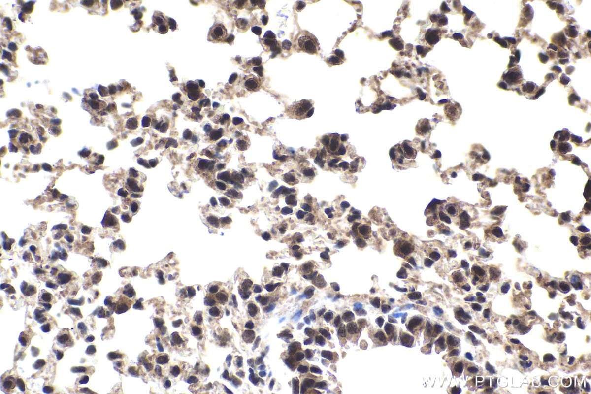 Immunohistochemical analysis of paraffin-embedded mouse lung tissue slide using KHC1701 (REST IHC Kit).