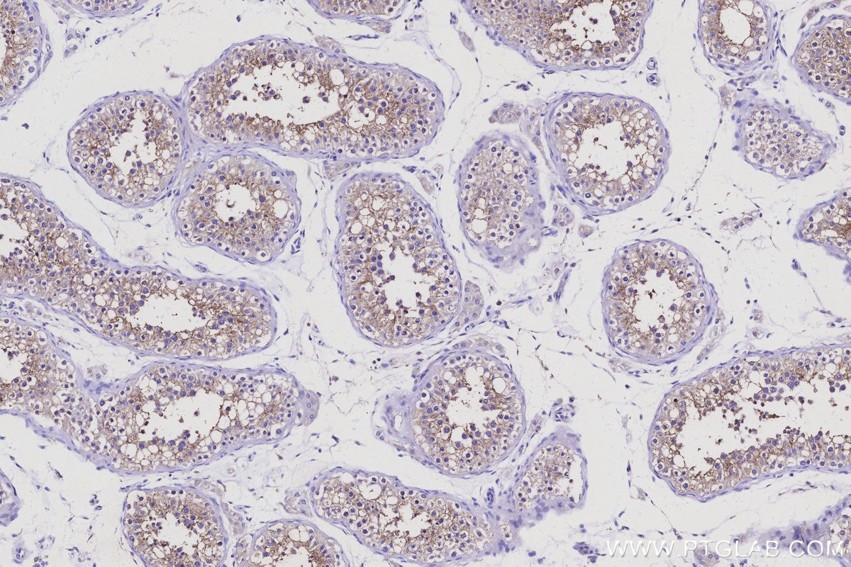 Immunohistochemical analysis of paraffin-embedded human testis tissue slide using KHC3113 (RGPD5 IHC Kit).