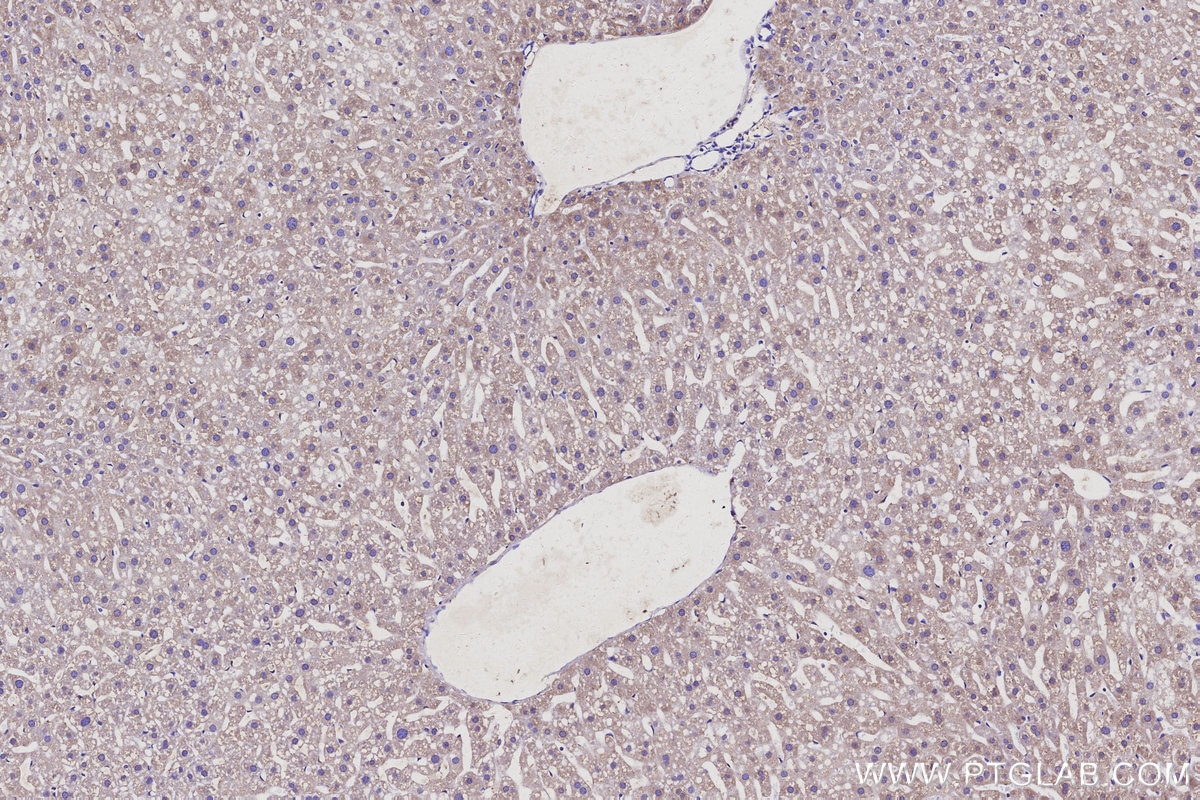 Immunohistochemical analysis of paraffin-embedded mouse liver tissue slide using KHC3113 (RGPD5 IHC Kit).