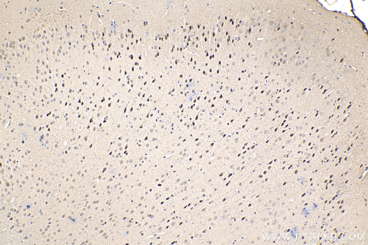 Immunohistochemical analysis of paraffin-embedded mouse brain tissue slide using KHC1454 (RGS14 IHC Kit).