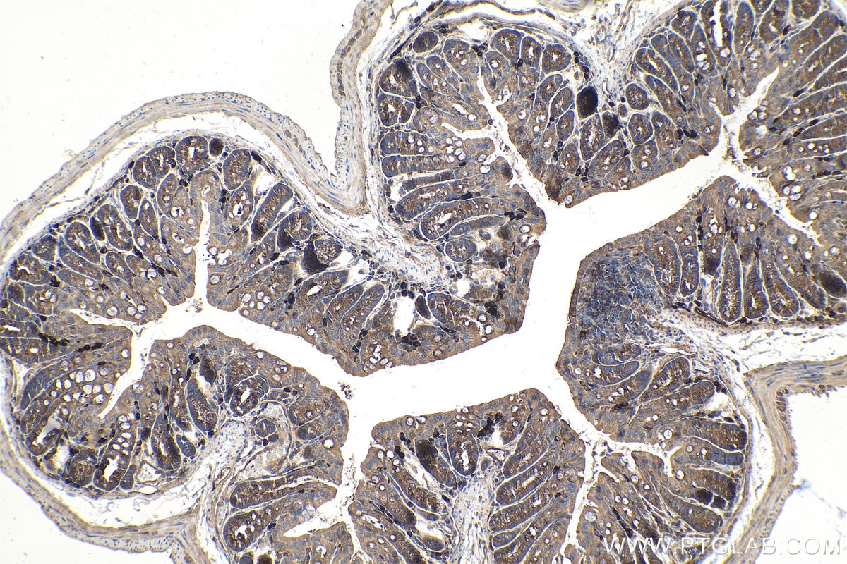 Immunohistochemical analysis of paraffin-embedded mouse colon tissue slide using KHC1454 (RGS14 IHC Kit).