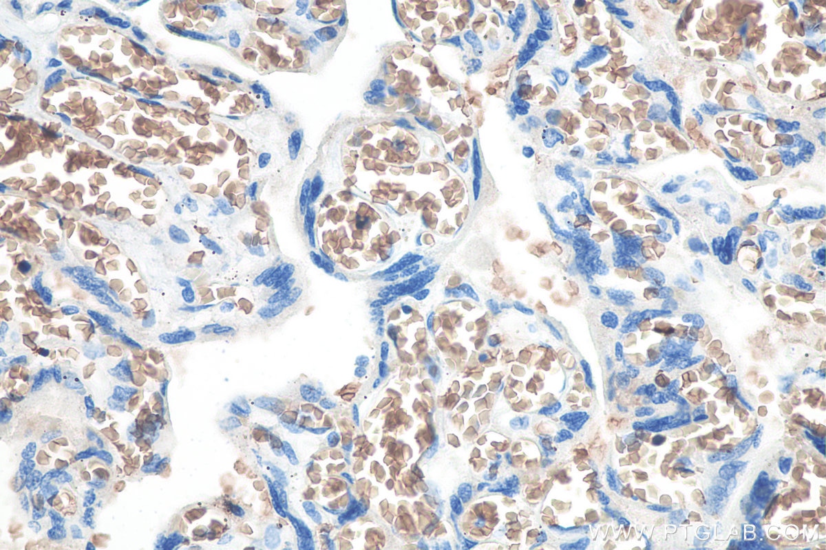 Immunohistochemical analysis of paraffin-embedded human placenta tissue slide using KHC0075 (RHAG IHC Kit).