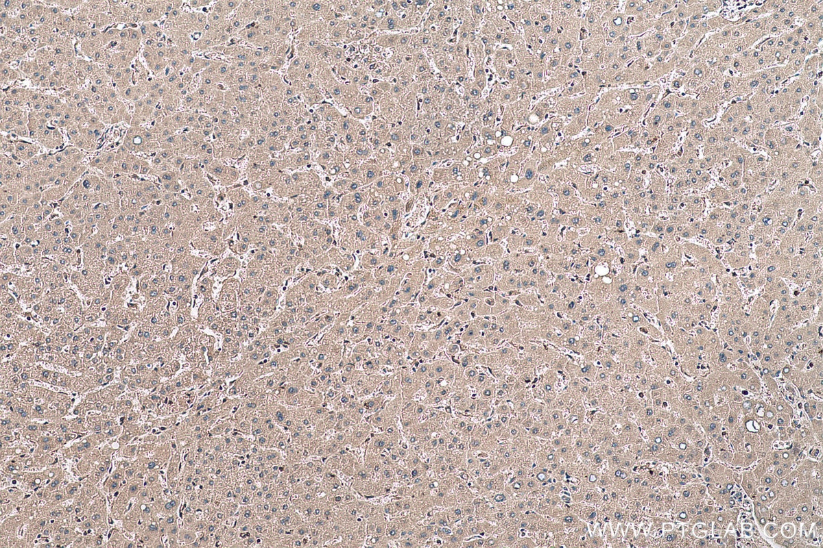 Immunohistochemical analysis of paraffin-embedded human liver tissue slide using KHC0638 (RHOA IHC Kit).