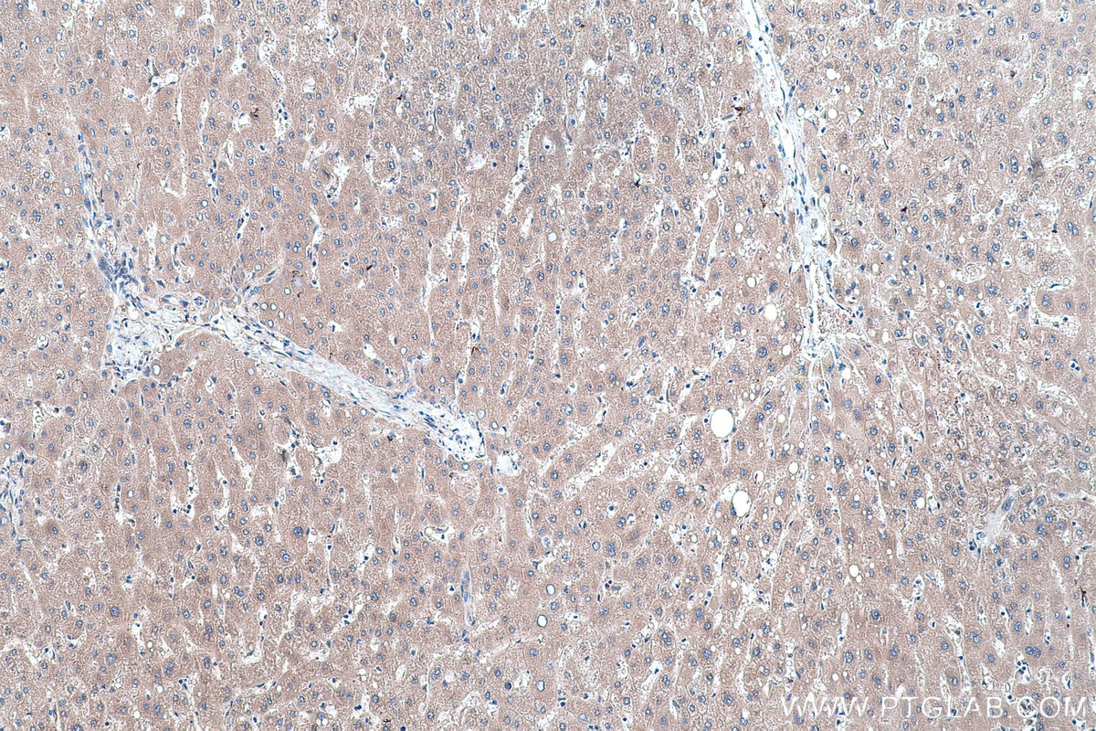 Immunohistochemical analysis of paraffin-embedded human liver tissue slide using KHC0454 (RHOB IHC Kit).