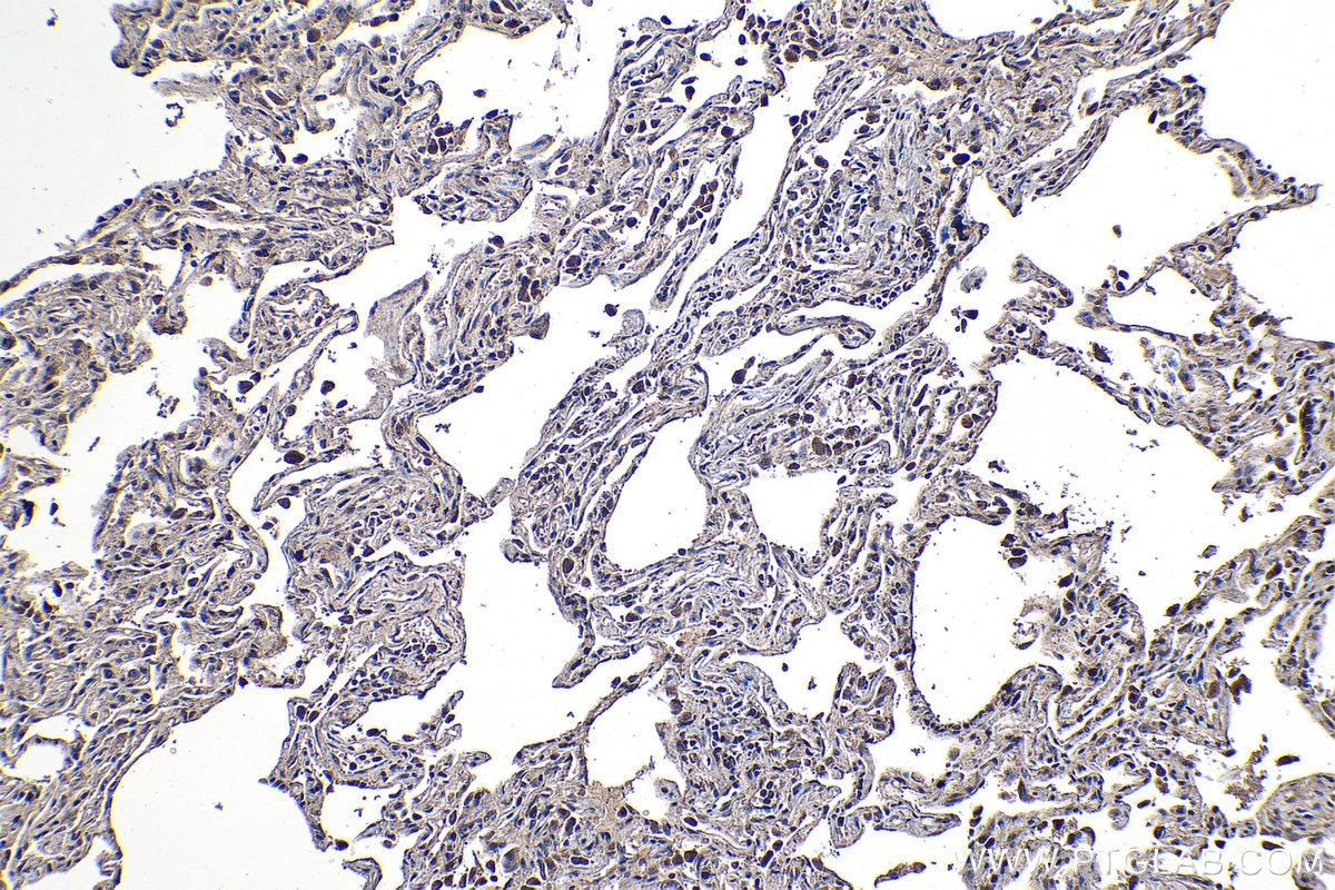 Immunohistochemical analysis of paraffin-embedded human lung tissue slide using KHC1256 (RIBC2 IHC Kit).