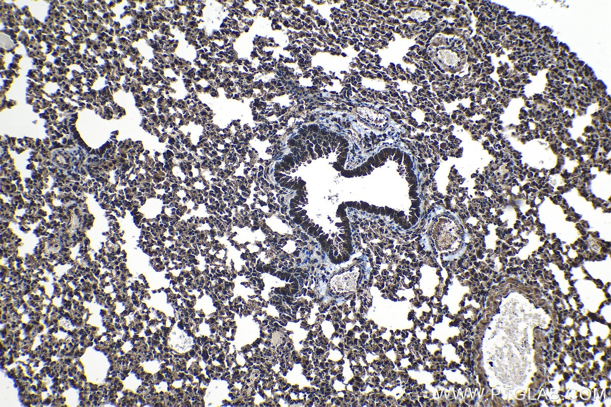 Immunohistochemical analysis of paraffin-embedded mouse lung tissue slide using KHC1256 (RIBC2 IHC Kit).