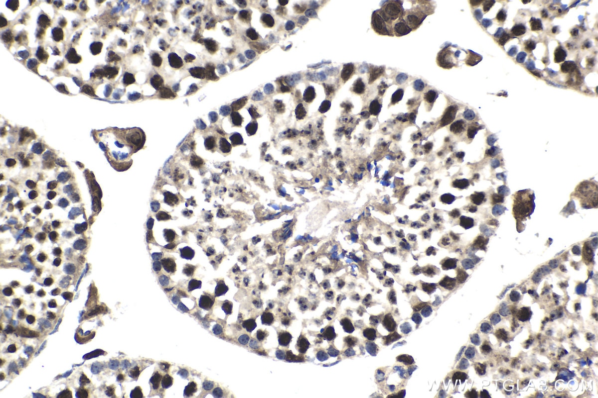 Immunohistochemical analysis of paraffin-embedded mouse testis tissue slide using KHC1780 (RIF1 IHC Kit).