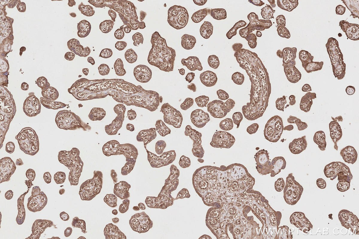Immunohistochemical analysis of paraffin-embedded human placenta tissue slide using KHC2858 (RIOK1 IHC Kit).