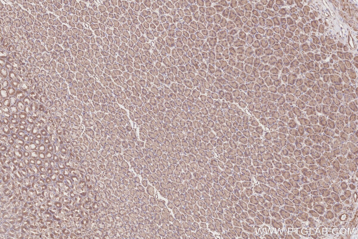 Immunohistochemical analysis of paraffin-embedded rat stomach tissue slide using KHC2858 (RIOK1 IHC Kit).