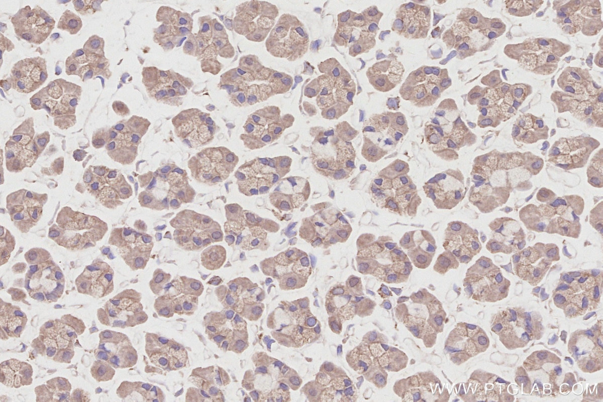 Immunohistochemical analysis of paraffin-embedded rat stomach tissue slide using KHC2874 (RIOK2 IHC Kit).
