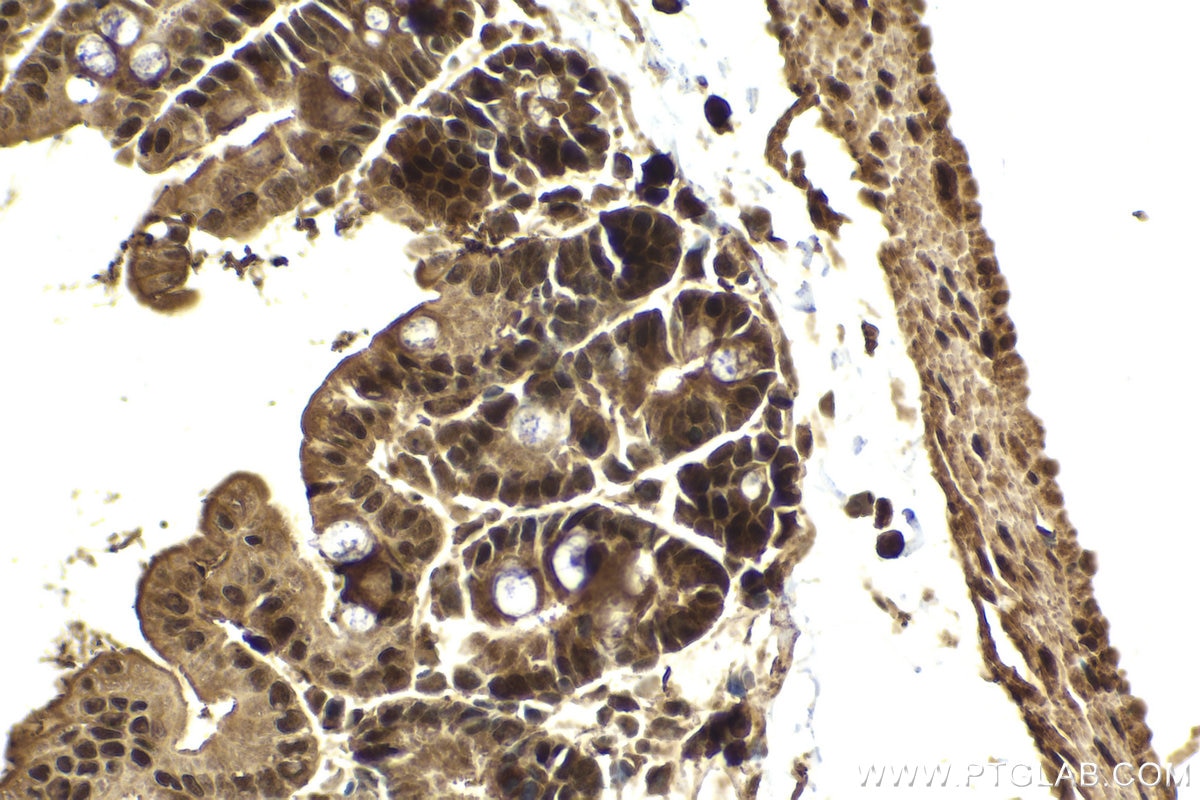 Immunohistochemical analysis of paraffin-embedded mouse small intestine tissue slide using KHC2025 (RIPK3 IHC Kit).